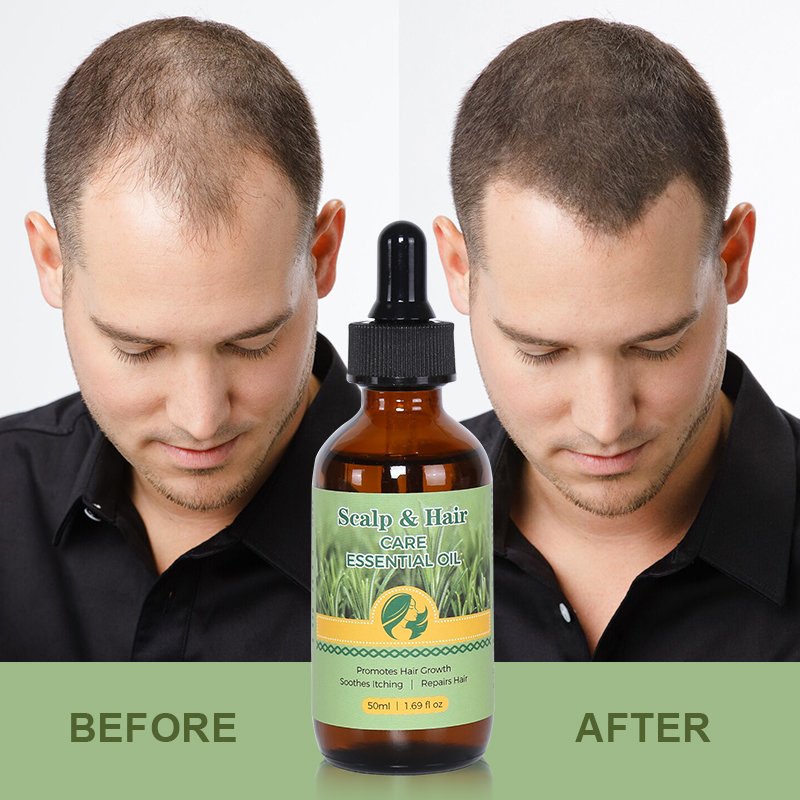 Natural Long Hair Oil - 12